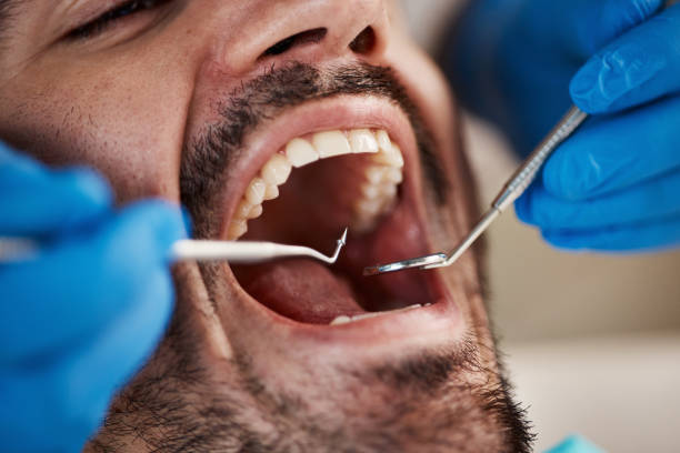 Best Emergency Dental Care for Broken or Chipped Teeth in Lewes, DE